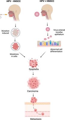 A deep learning method for classification of HNSCC and HPV patients using single-cell transcriptomics